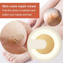 Load image into Gallery viewer, Anti-cracking Winter Cream
