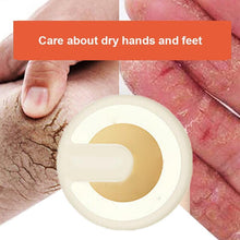 Load image into Gallery viewer, Anti-cracking Winter Cream