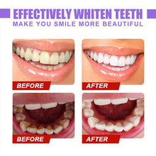 Load image into Gallery viewer, Dental Color Corrector💗