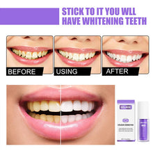 Load image into Gallery viewer, Dental Color Corrector💗