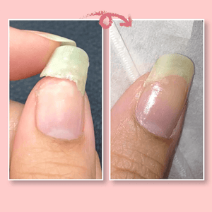 🔥2022 Hot Sale🔥NAIL REPAIR PROTECTION GEL