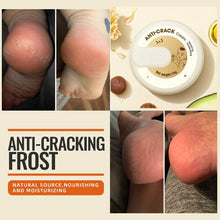 Load image into Gallery viewer, Anti-cracking Winter Cream