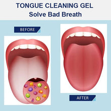 Load image into Gallery viewer, Tongue Cleaning Gel Set