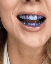 Load image into Gallery viewer, Dental Color Corrector💗