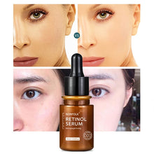 Load image into Gallery viewer, Retinol Facial Serum