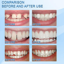 Load image into Gallery viewer, Latest👨‍⚕Tooth Repair Granules🔥HOT SALE🔥🎉
