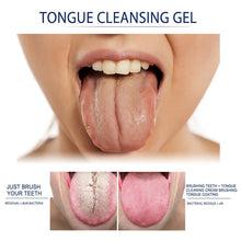 Load image into Gallery viewer, Tongue Cleaning Gel Set
