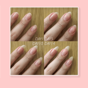 🔥2022 Hot Sale🔥NAIL REPAIR PROTECTION GEL