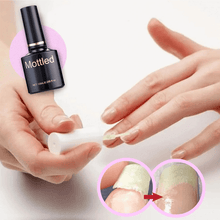 Load image into Gallery viewer, 🔥2022 Hot Sale🔥NAIL REPAIR PROTECTION GEL
